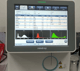 Mindray BC-20 CBC machine product image