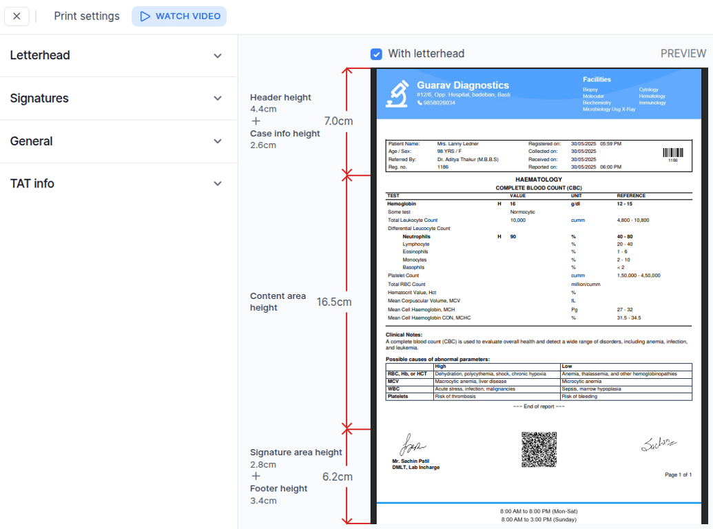 Report customiztion